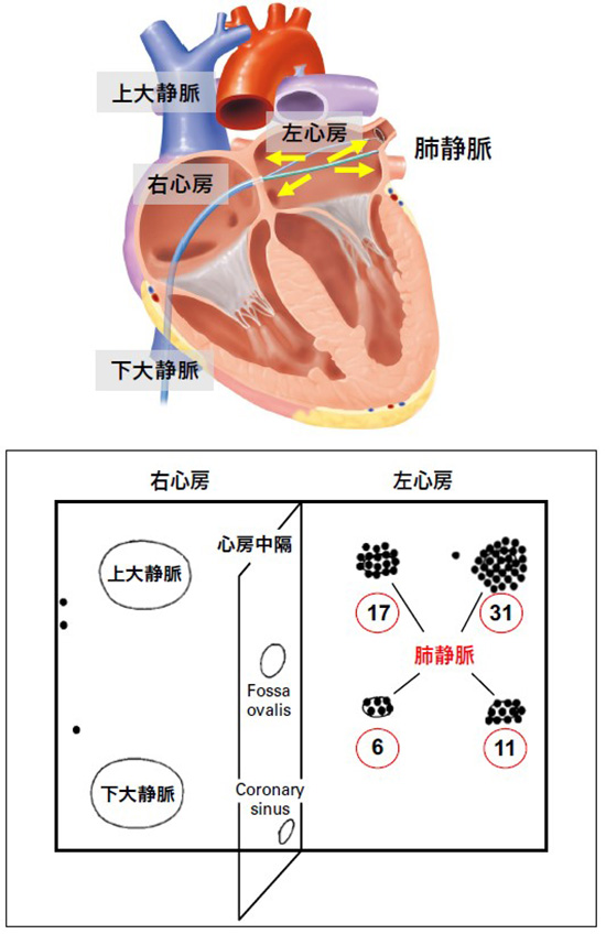 心臓内部のイメージ図スマホ用