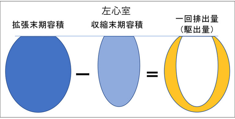 拡張末期容積の増加は心臓にどのような影響を与えるのでしょうか?