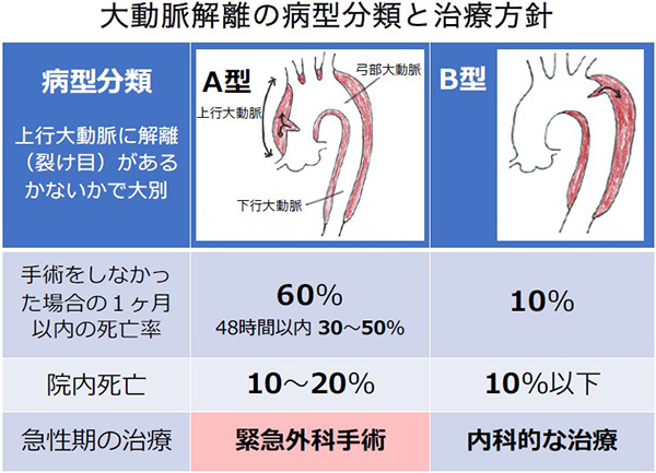 大動脈解離の病型分類